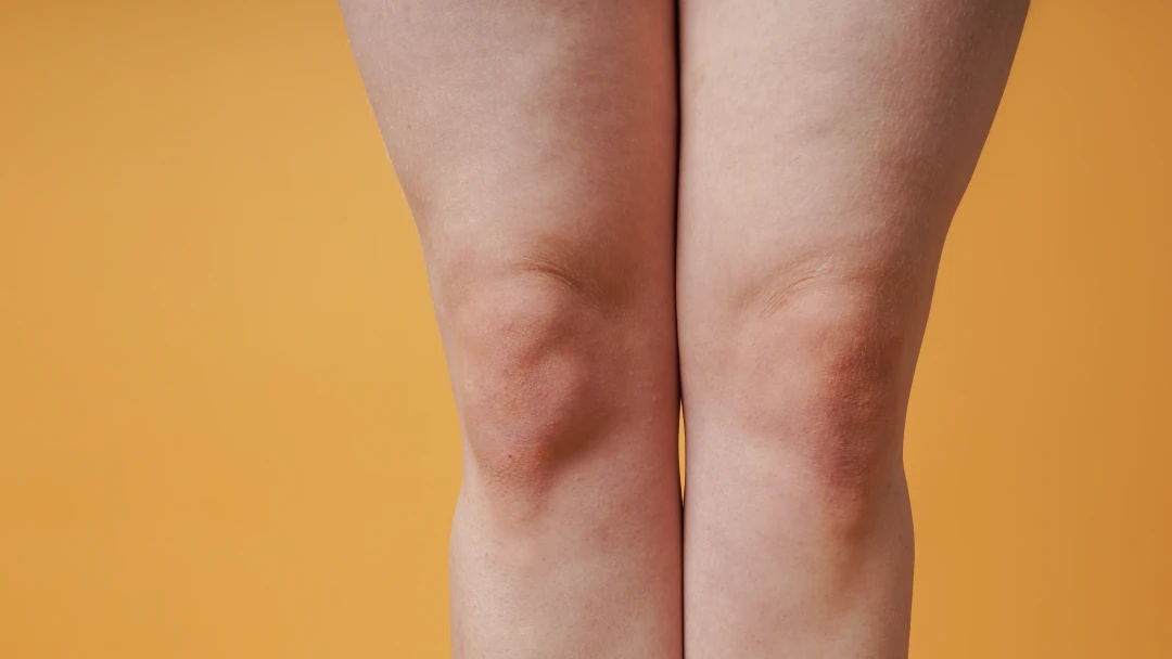 Varicose and Venous Disease Treatment visual